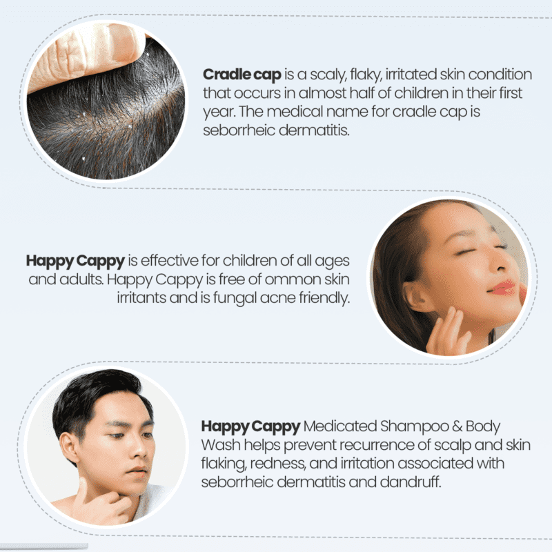 HAPPY CAPPY ARTICLES