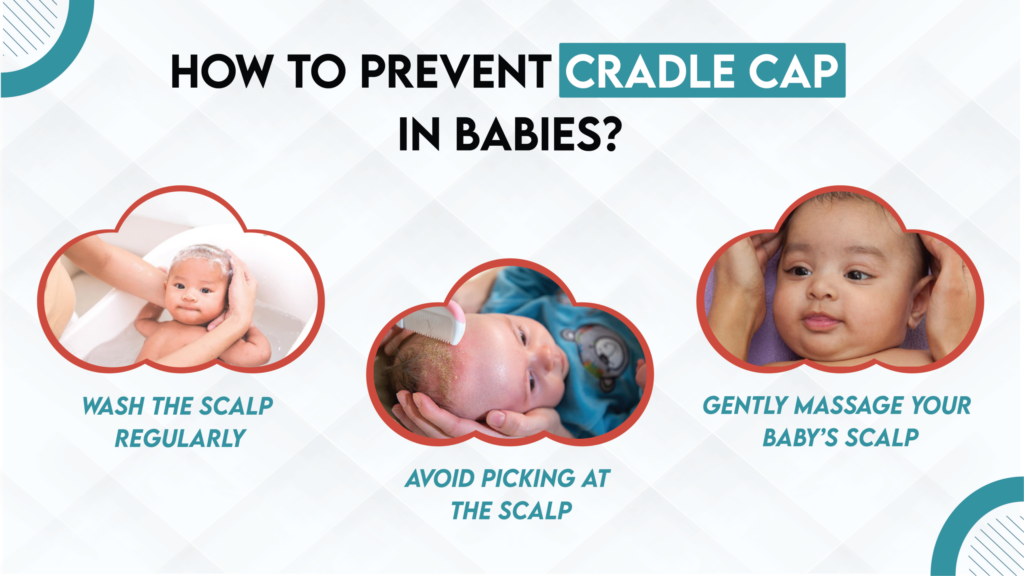 How to Prevent Cradle Cap: What Do You Need to Know? How to Prevent Cradle Cap: What Do You Need to Know?