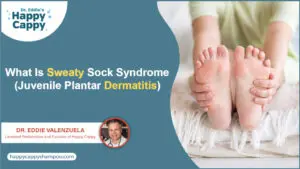 What Is Sweaty Sock Syndrome (Juvenile Plantar Dermatitis)