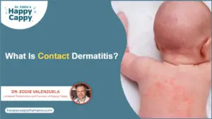 What Is Contact Dermatitis?