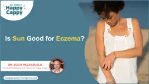 is sun good for eczema