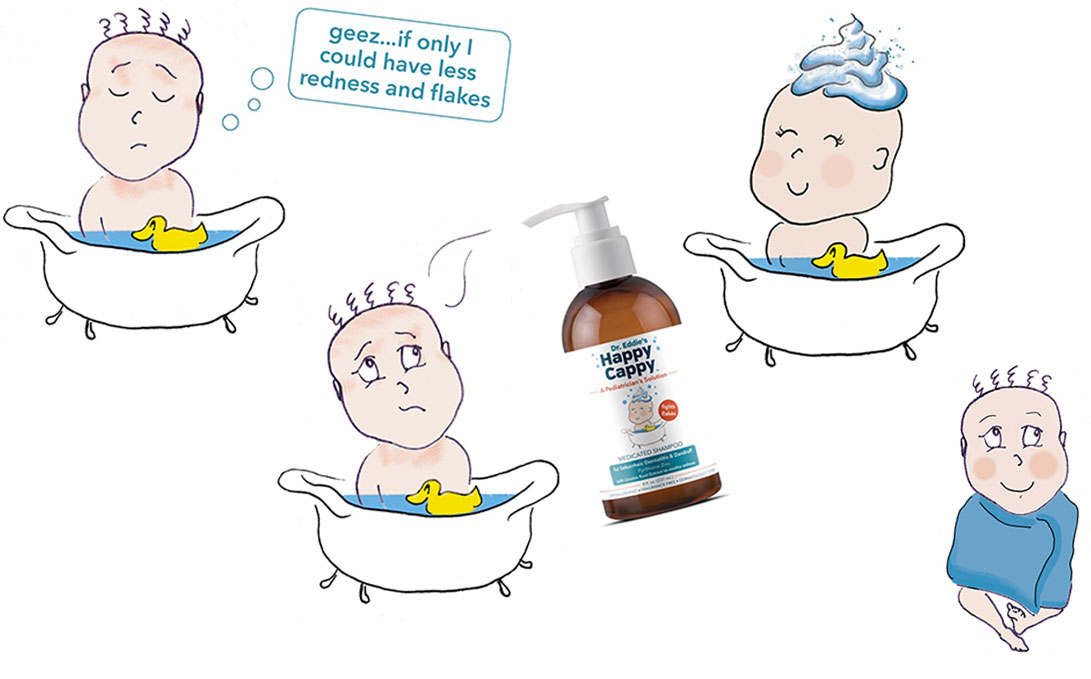 Shampoo para la Dermatitis Seborreica Infantil