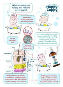 First-page preview of the Understanding Seborrheic Dermatitis handout