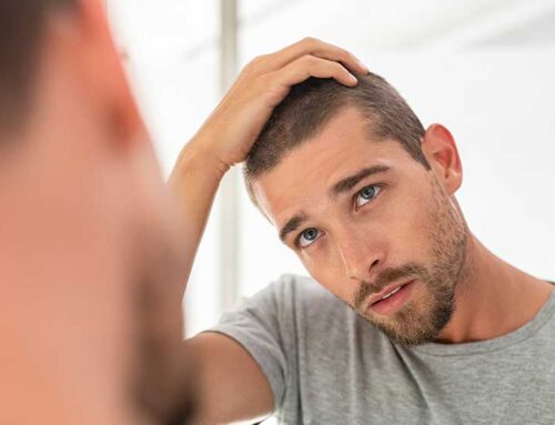 Desintoxicación cuero cabelludo:¿Como se debe desintoxicar un cuero cabelludo?