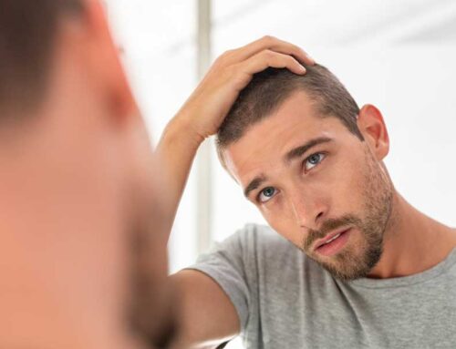 Salud del cuero cabelludo: De que trata la salud del cuero cabelludo