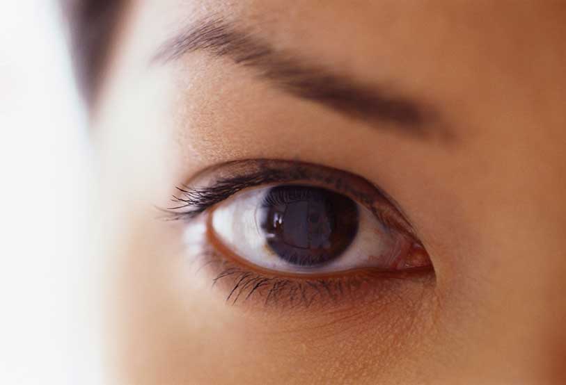 What Cream Can I Use for Eczema on My Eyelids?