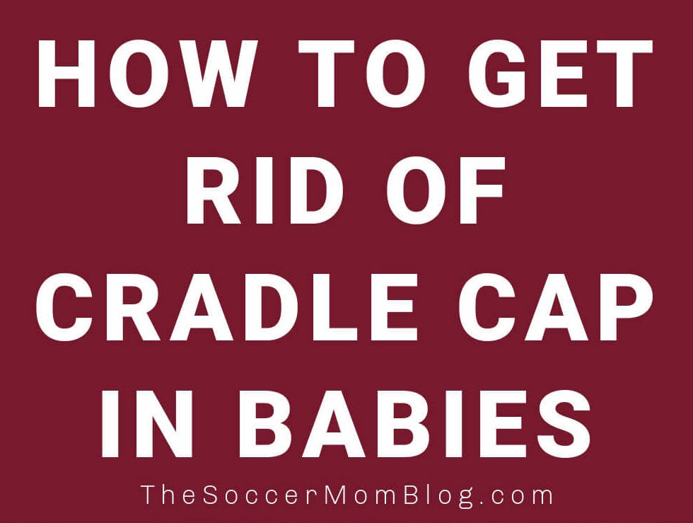 How to Get Rid of Cradle Cap in Babies