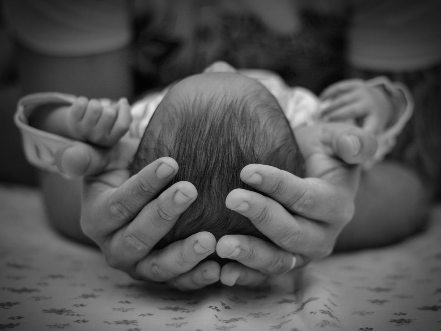 Escamas En La Cabeza Del Bebe: ¿Son Escamas En La Caspa De Mi Bebé?