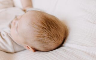 Close up of baby with dry scalp