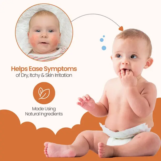 eczema symptoms