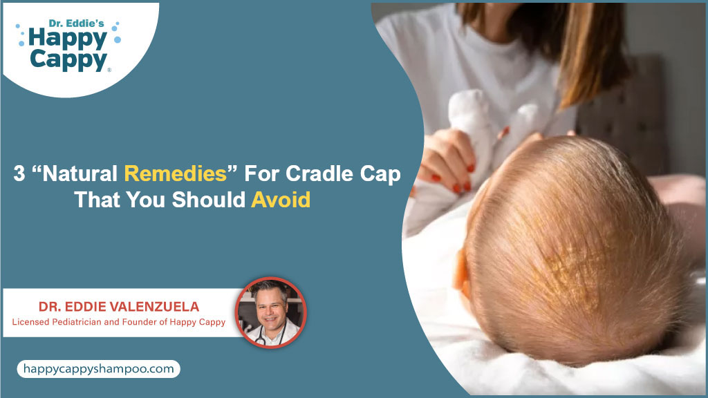 3 “Natural Remedies” for Cradle Cap That You Should Avoid