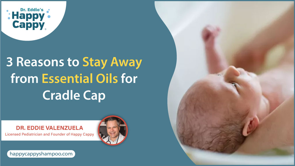 3 Reasons to Stay Away from Essential Oils for Cradle Cap