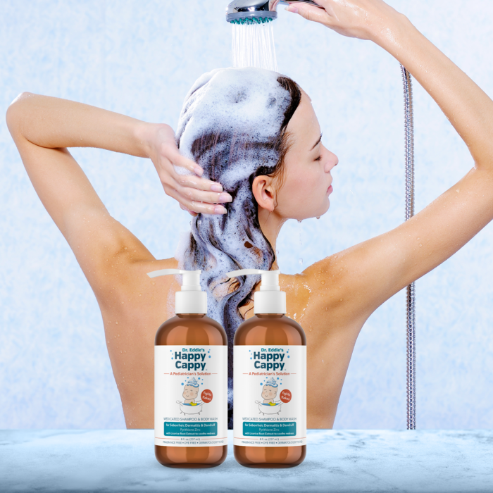Adult Cradle Cap Shampoo for Teenage Dandruff, Adult Seborrheic Dermatitis, & Fungal Acne