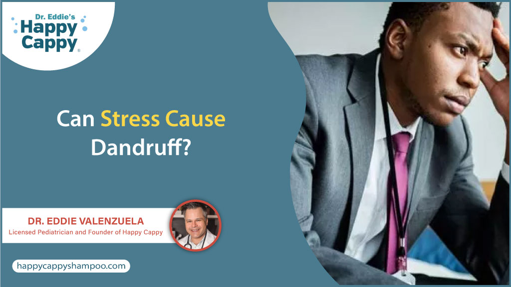 Does stress cause dandruff?