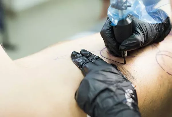 El eczema cuidados:¿Pueden coexistir los tatuajes y el eczema?