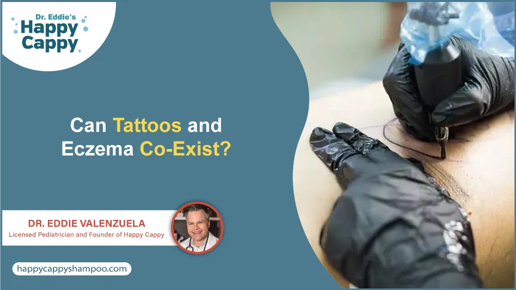 Can Tattoos and Eczema Co-Exist?