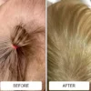 cradle cap before and after