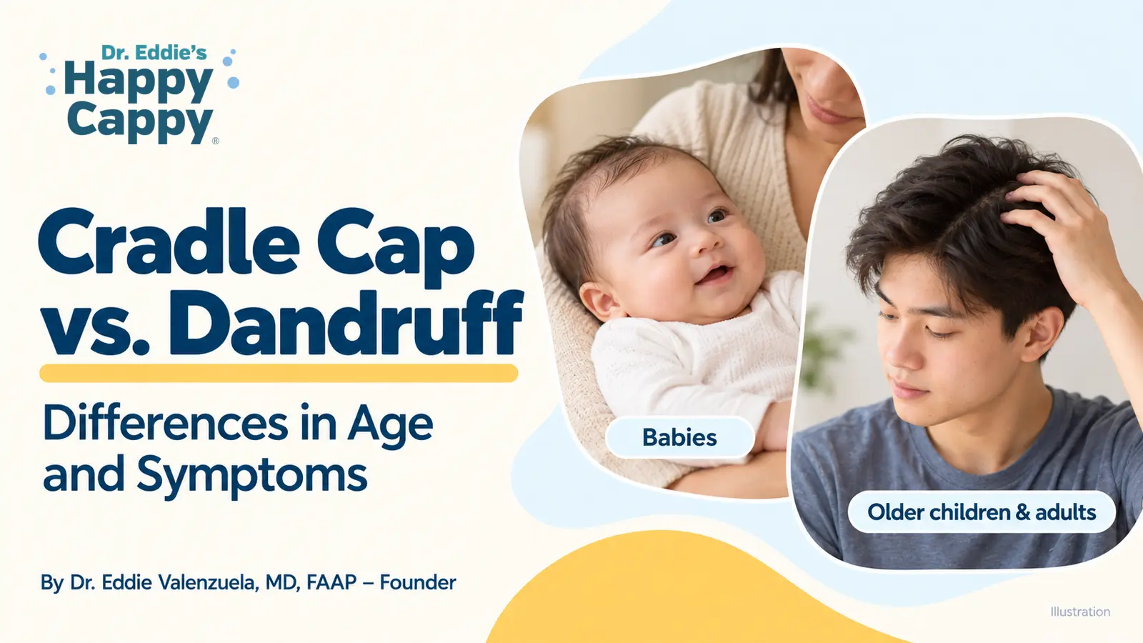 Cradle Cap vs. Dandruff: Differences in Age and Symptoms