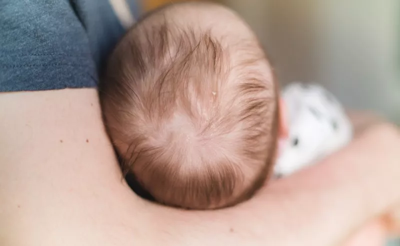 Cradle cap vs dry skin in babies