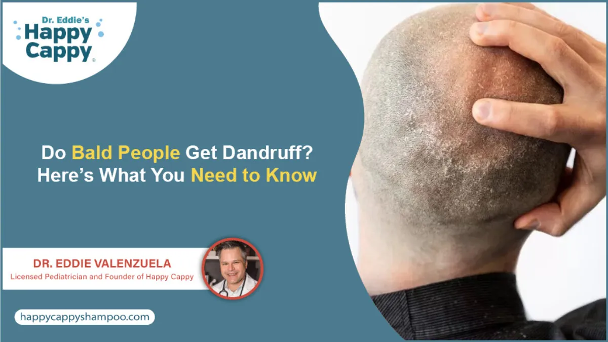 Do Bald People Get Dandruff? Here&rsquo;s What You Need to Know - Happy 