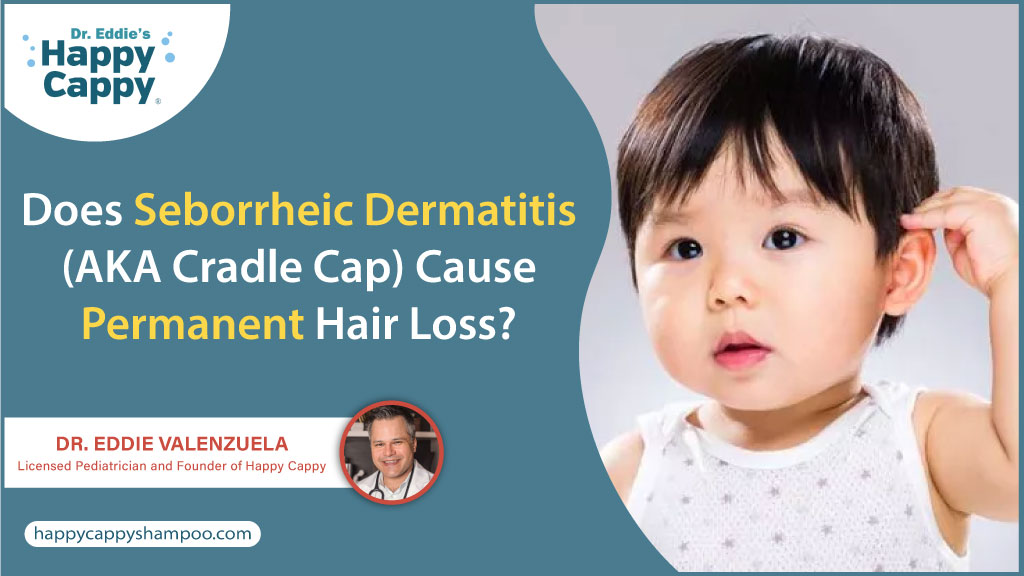 Does Seborrheic Dermatitis (AKA Cradle Cap) Cause Permanent Hair Loss?