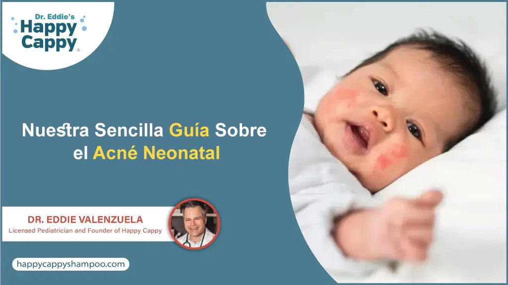 Nuestra guía sencilla para el acné neonatal