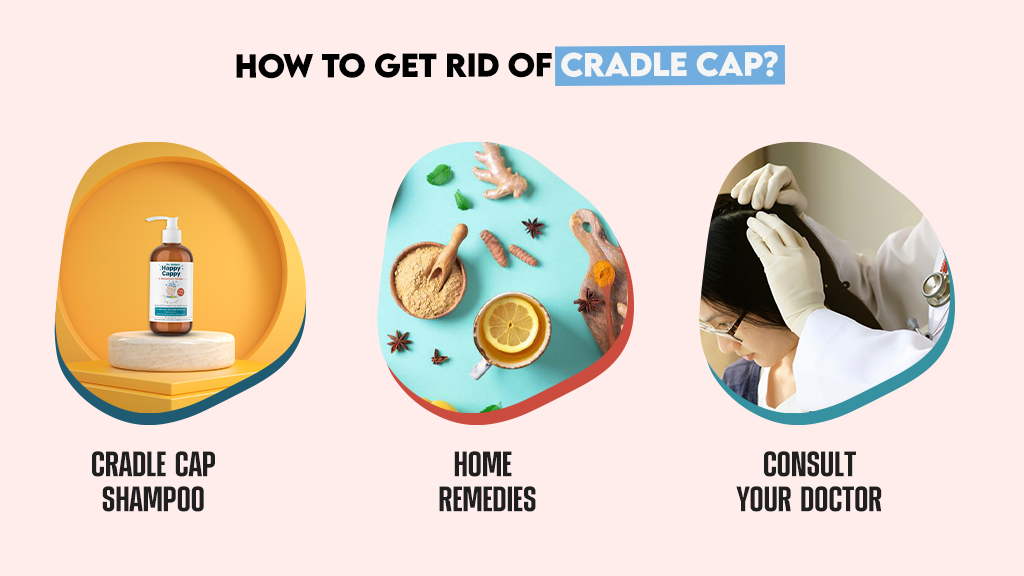 How to Get Rid of Cradle Cap?