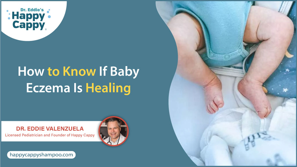 How do you know if a child with eczema is healing?