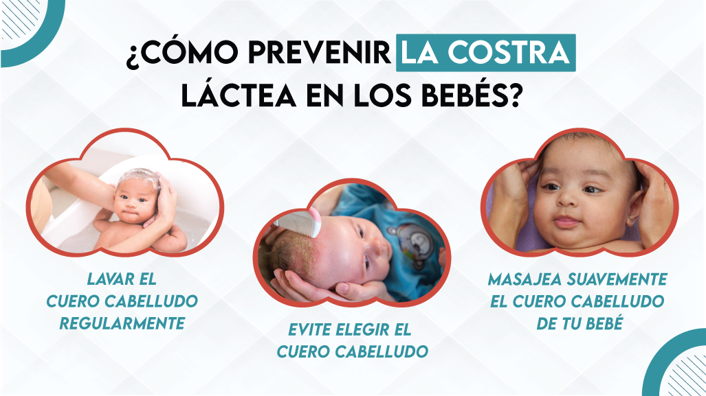 ¿Cómo Prevenir la Costra Láctea en los Bebés?