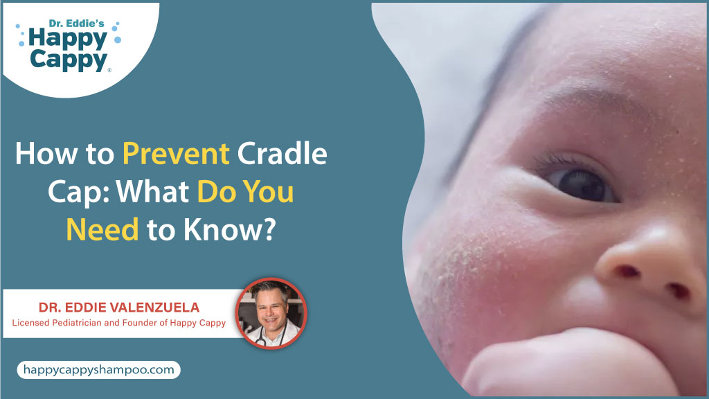 How to prevent cradle cap in babies naturally