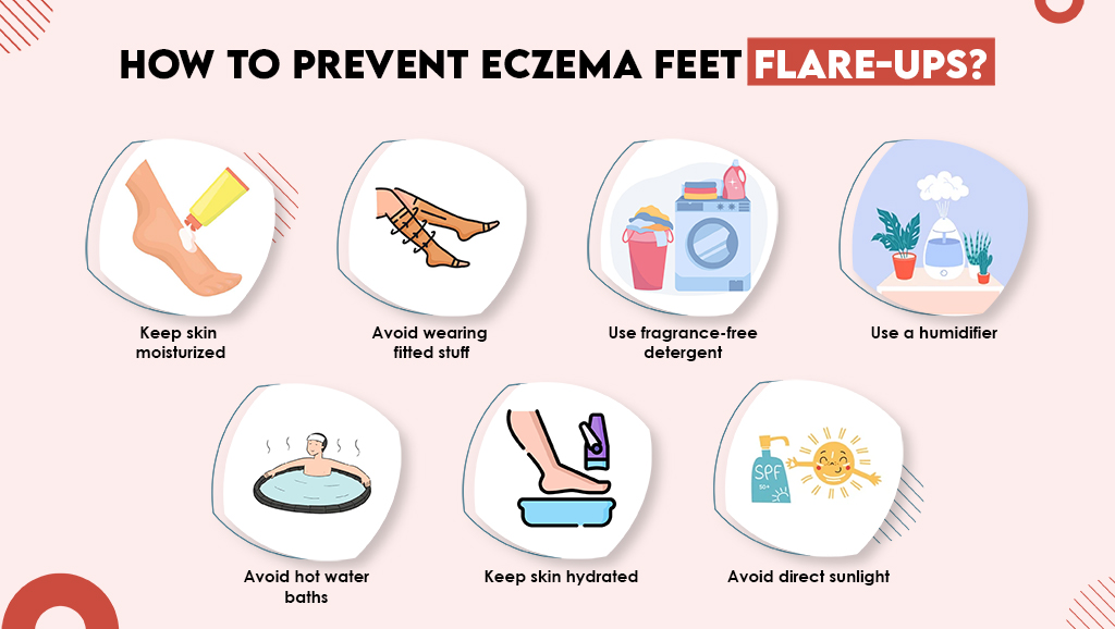 How to Prevent Eczema Feet Flare-ups?