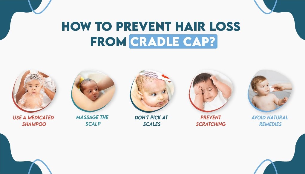 How to Prevent Hair Loss From Cradle Cap?