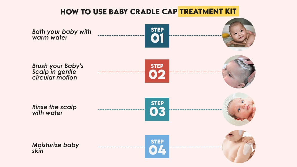 How to Use Baby Cradle Cap Treatment Kit