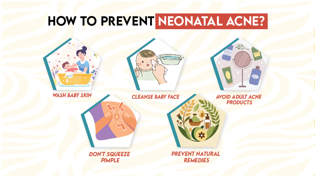 How to Prevent Neonatal Acne?