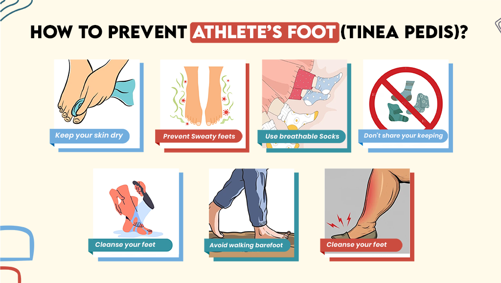 How to prevent athlete’s foot (Tinea Pedis)?