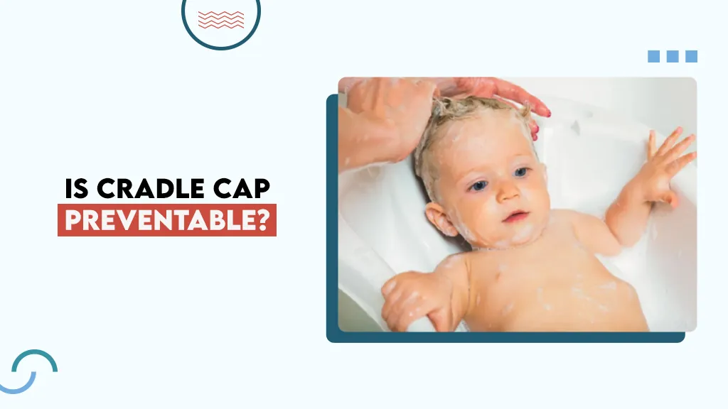 Is Cradle Cap Preventable?