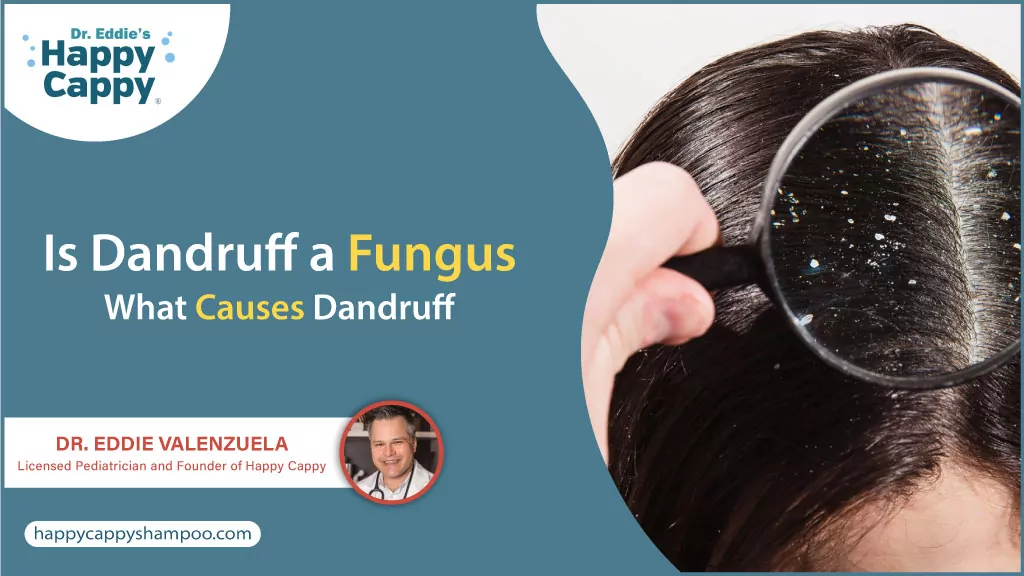 Is Dandruff a Fungus?