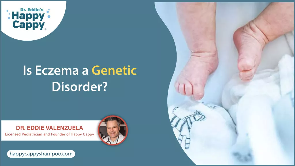 Is Eczema a Genetic Disorder?