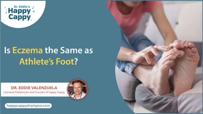 Is Eczema the Same as Athlete’s Foot? - Happy Cappy