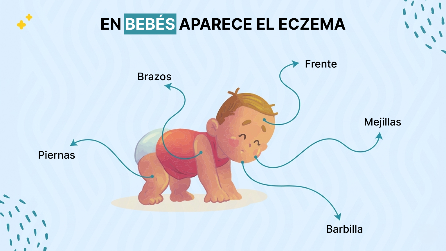¿Las Bebés Superan El Eczema?
