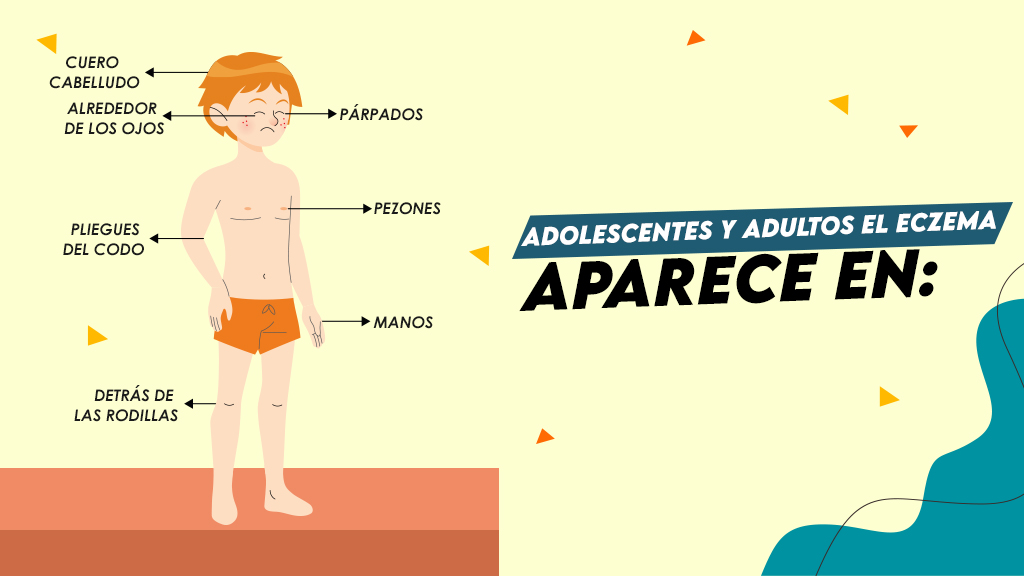 ¿Puede Desarrollarse Eczema a Cualquier Edad?