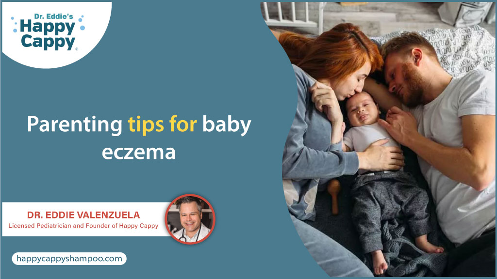 Parenting tips for baby eczema