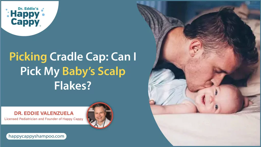 Picking Cradle Cap: Can I Pick My Baby’s Scalp Flakes?