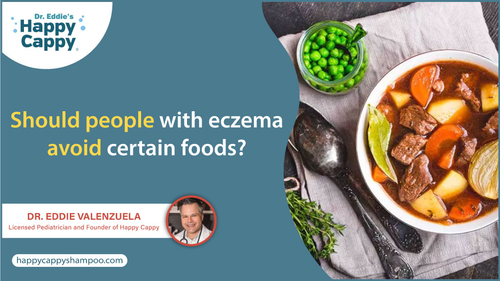 people with eczema avoid certain foods