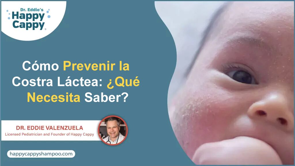 Cómo Prevenir la Costra Láctea