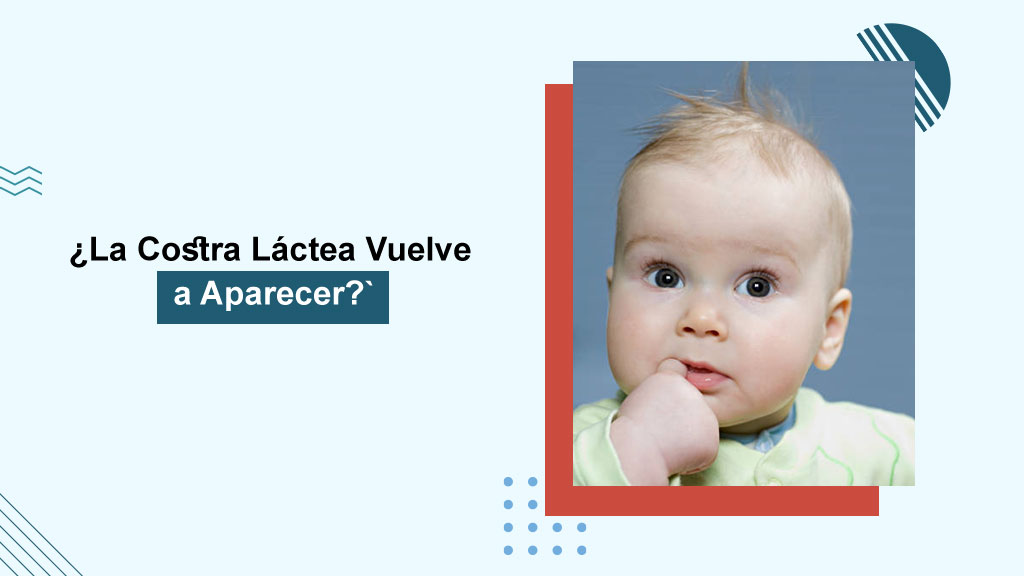 ¿La Costra Láctea Vuelve a Aparecer?