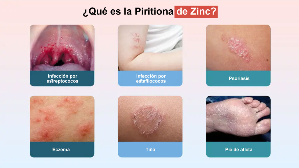 ¿Qué es la Piritiona de Zinc?