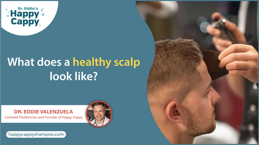 What does a healthy scalp look like?