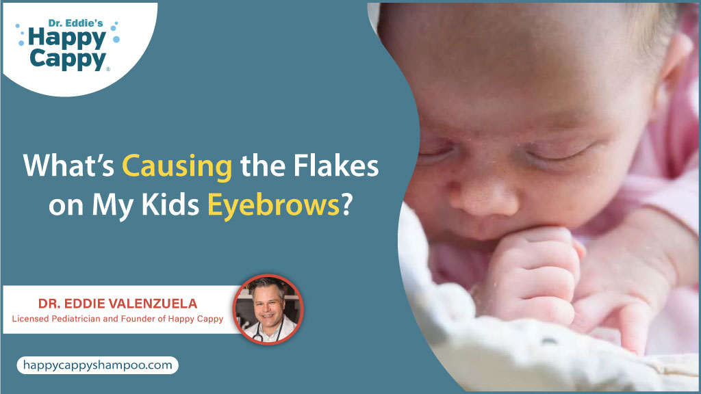 What causes dandruff on my children's eyebrows?