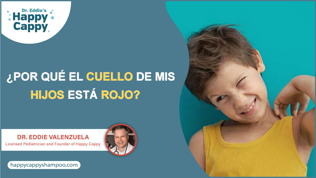 ¿Por qué el cuello de mis hijos está rojo?